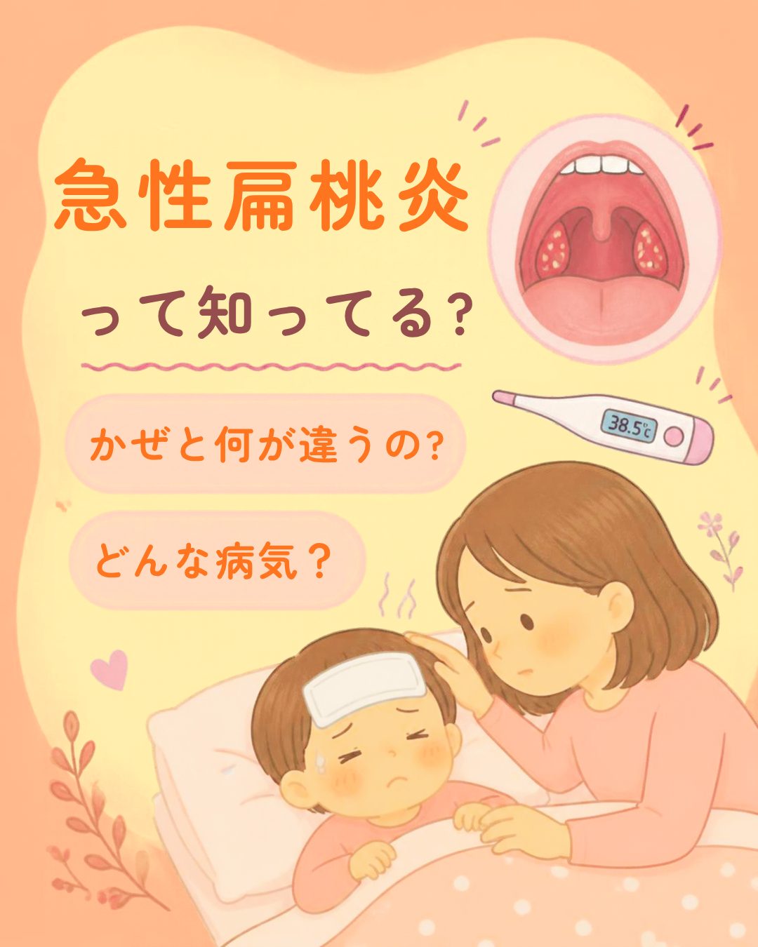 急性扁桃炎とは?かぜとの違いや症状を紹介するイラスト