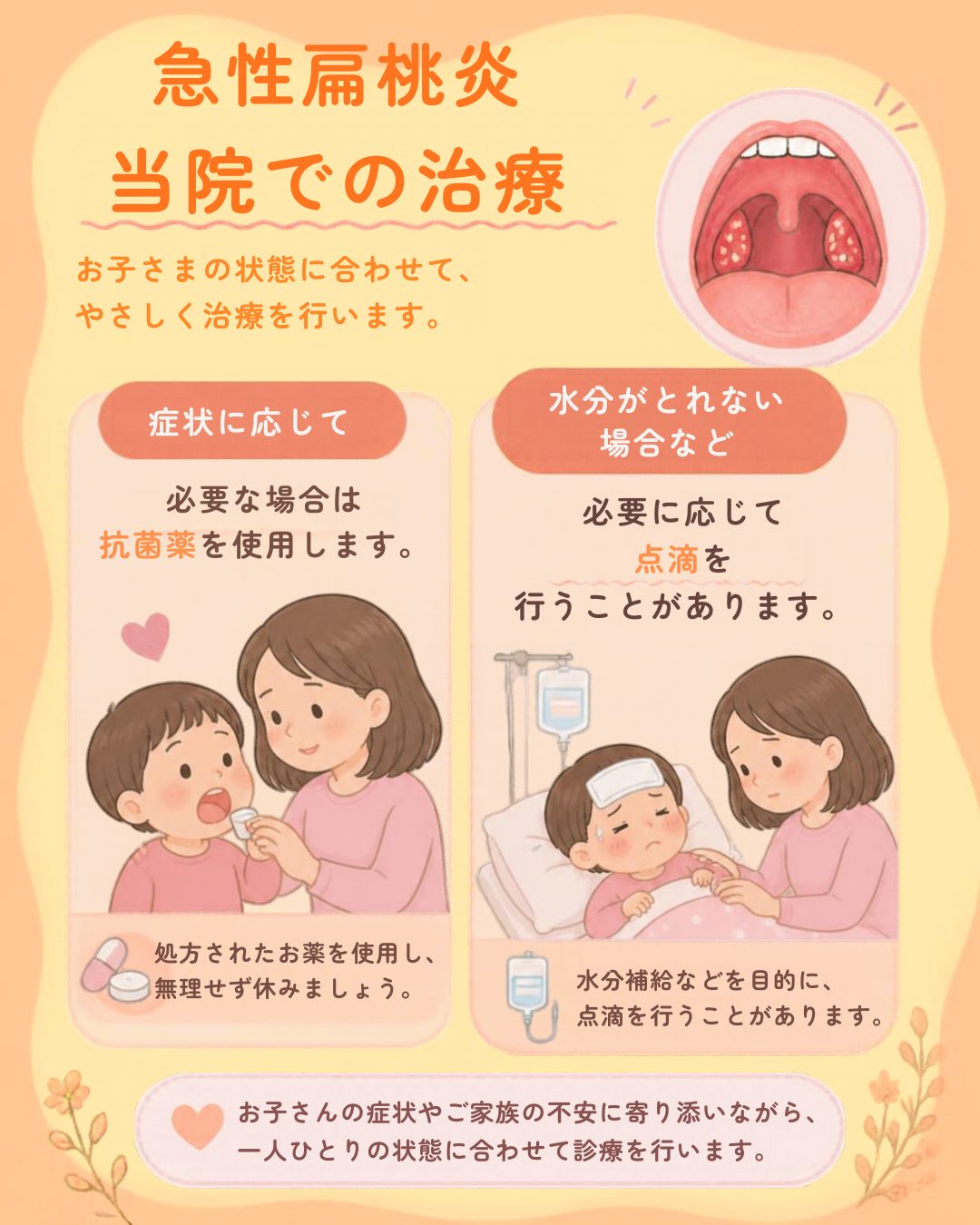 子どもの急性扁桃炎に対する薬による治療と必要に応じた点滴の説明