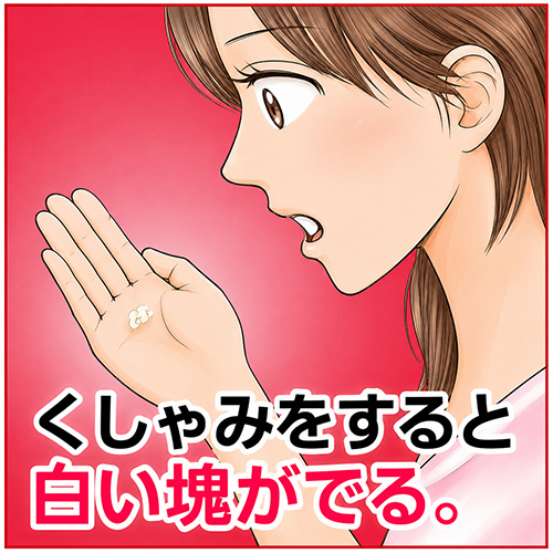 膿栓
